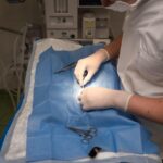 cat dureaza operatia de tiroida